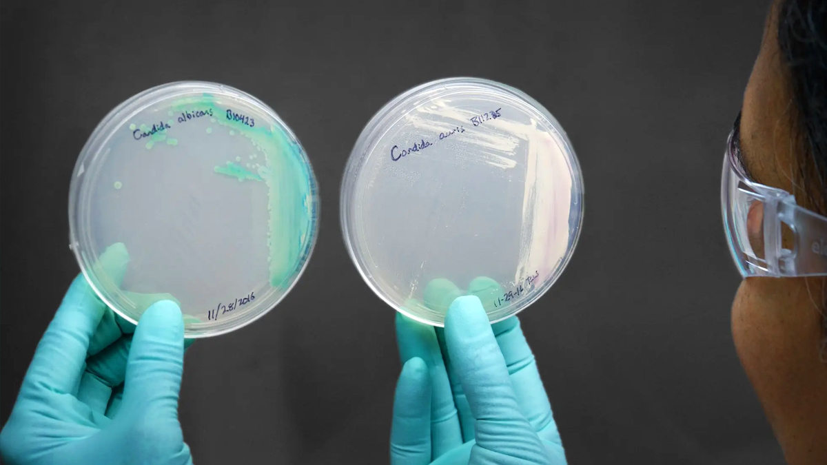 A lab scientist hold two closed petri dishes with strains of Candidozyma auris