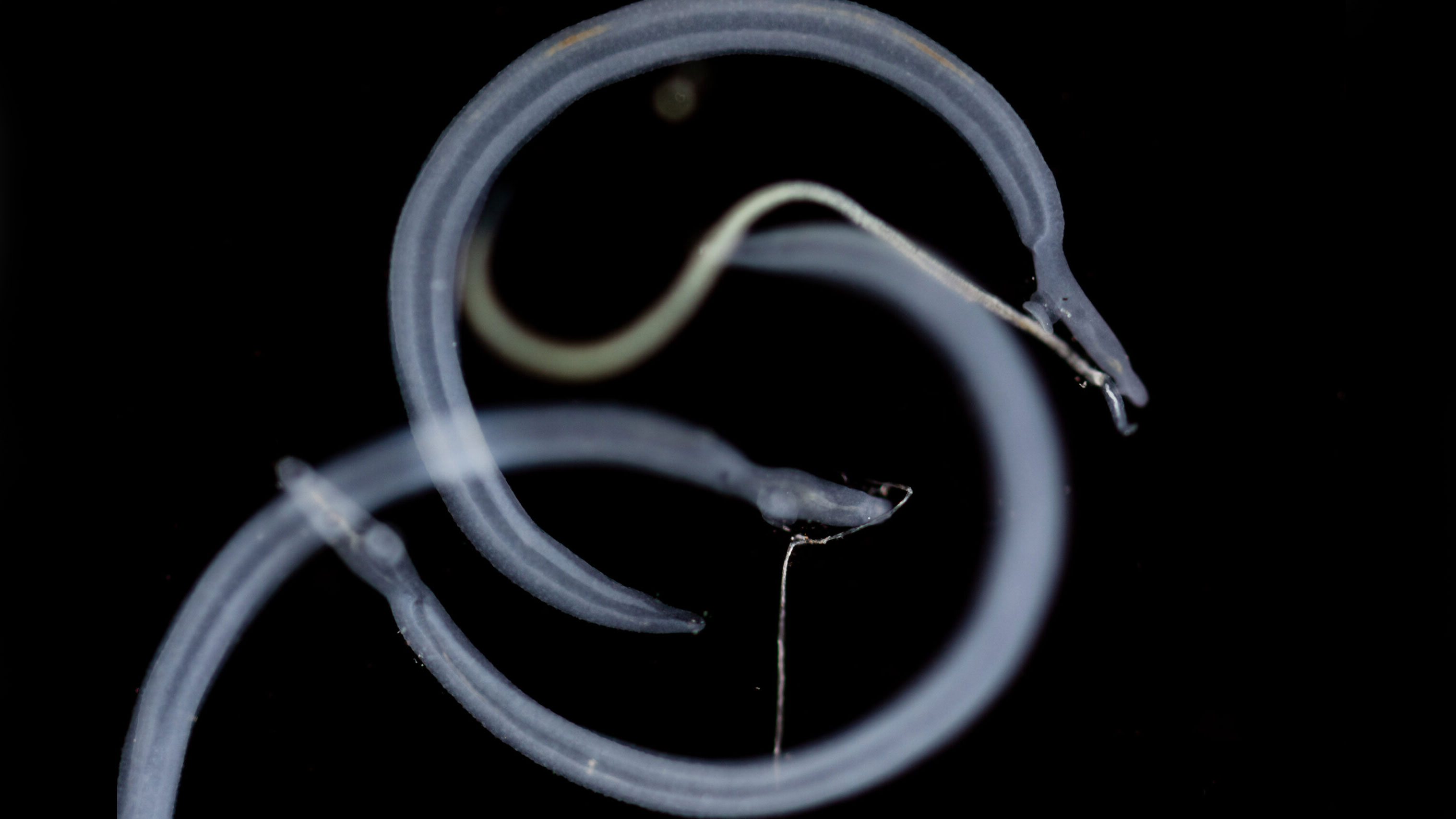 Schistosomiasis, a disease caused by parasitic worms, affects more than 250 million people worldwide.