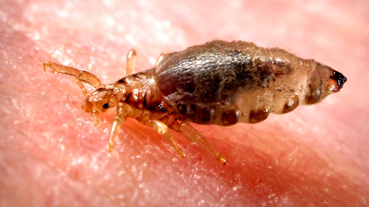 A louse on a human body.