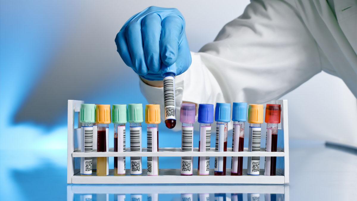 Lab Image of a laboratorian placing a test tube in a holder