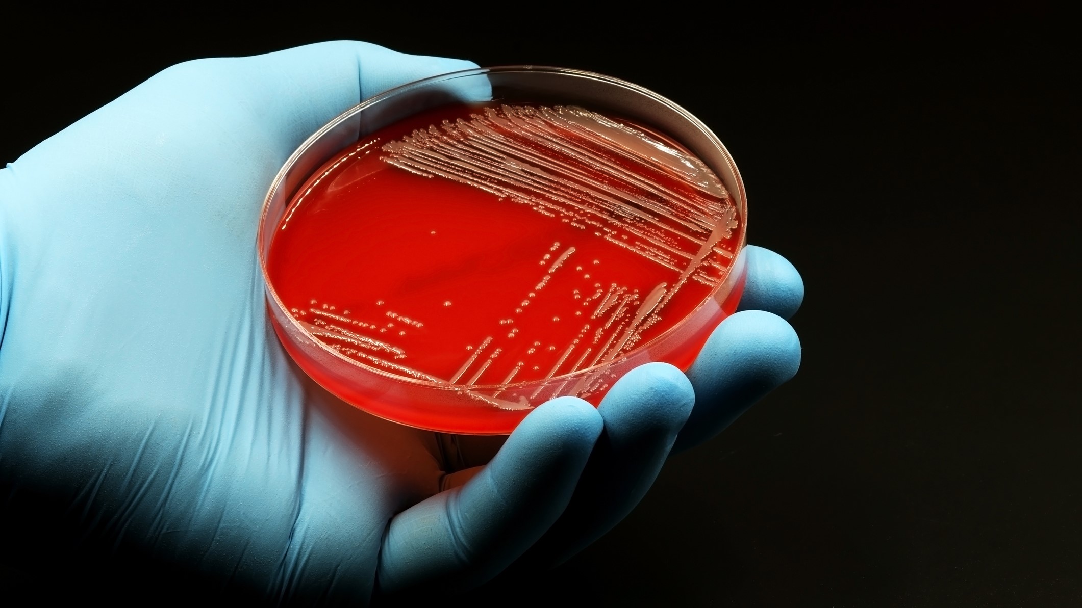 A hand wearing a blue glove is holding a petri dish with Campylobacter growing on a red medium.