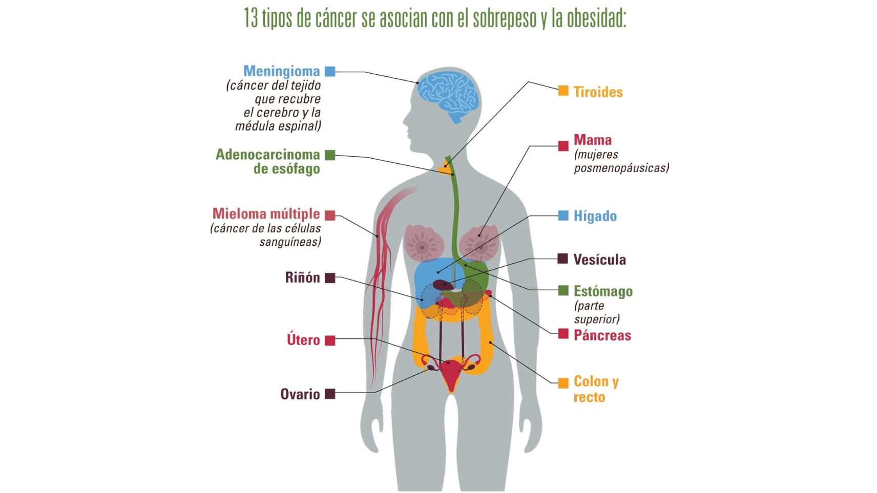 13 tipos de c&aacute;ncer se asocian con el sobrepeso y la obesidad: meningioma (c&aacute;ncer del tejido que recubre el cerebro y la m&eacute;dula espinal); adenocarcinoma de es&oacute;fago Mieloma m&uacute;ltiple (c&aacute;ncer de las c&eacute;lulas sangu&iacute;neas); ri&ntilde;&oacute;n; &uacute;tero; ovario; tiroides; mama (mujeres posmenop&aacute;usicas); h&iacute;gado; ves&iacute;cula; est&oacute;mago (parte superior); p&aacute;ncreas; y colon y recto.