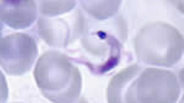 El parásito Trypanosoma cruzi (tripomastigote) en un frotis de sangre fino.