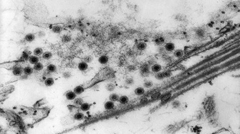 Electron microscope view of Colorado tick fever virus.