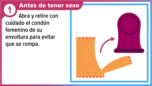 Un cond&oacute;n y su envoltorio abierto.