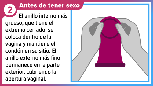 Un par de manos sosteniendo un cond&oacute;n femenino desde el anillo grueso, interno.