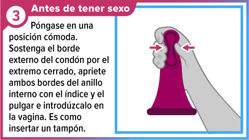 Una mano apretando el anillo grueso interno del cond&oacute;n femenino prepar&aacute;ndolo para ser insertarlo.