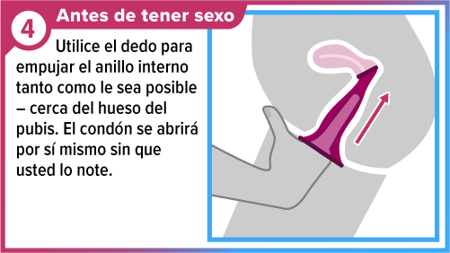 Dedo insertando el cond&oacute;n femenino dentro de la vagina.
