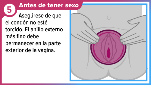 Un par de manos posicionando el cond&oacute;n femenino de manera que cubra la vulva.