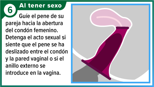 Cond&oacute;n femenino colocado, con el pene insertado dentro de la vagina.