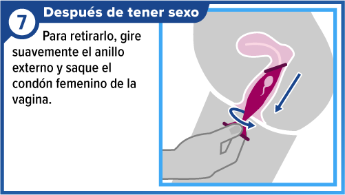 Mano retirando el cond&oacute;n femenino.