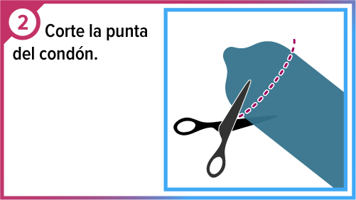 Tijeras cortando la punta del cond&oacute;n.