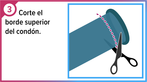 Tijeras cortando el borde superior del cond&oacute;n.