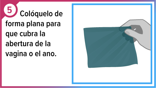 Mano sosteniendo el cond&oacute;n aplanado para usar como barrera bucal.