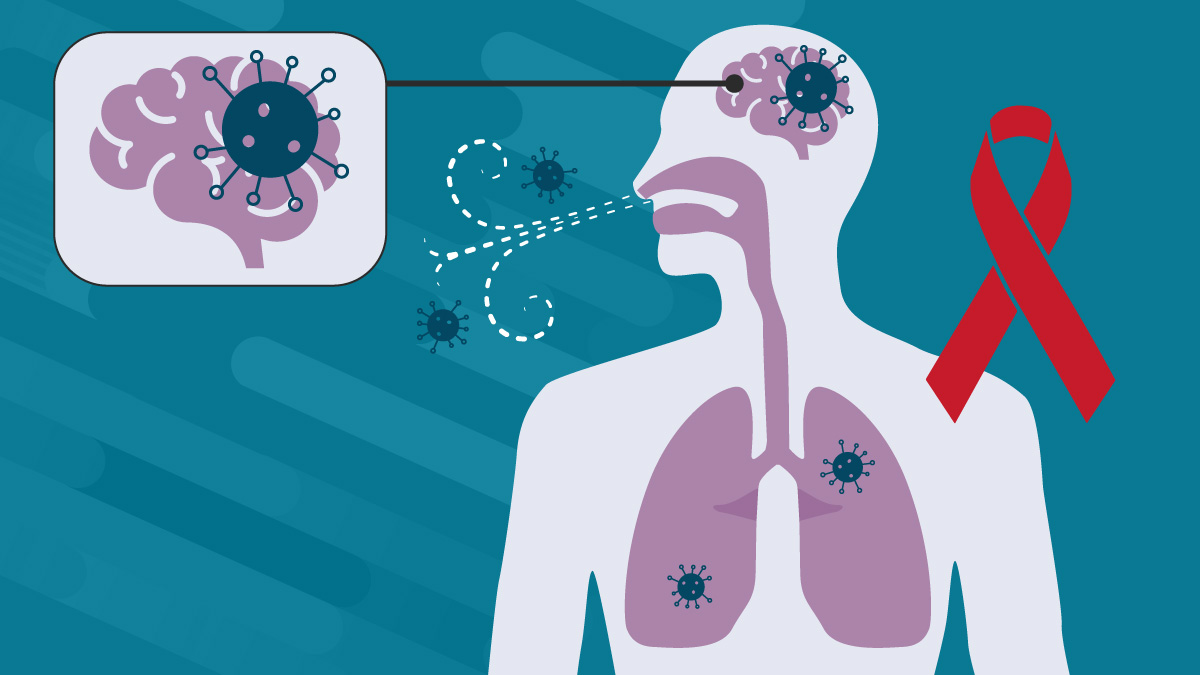 Cryptococcal meningitis Illustration of a sillouhette of a person breathing in spores depicted as dots and Cryptococcus.. The brain is highlighted showing cryptoccus in the brain from the lungs, An HIV ribbon is in the background