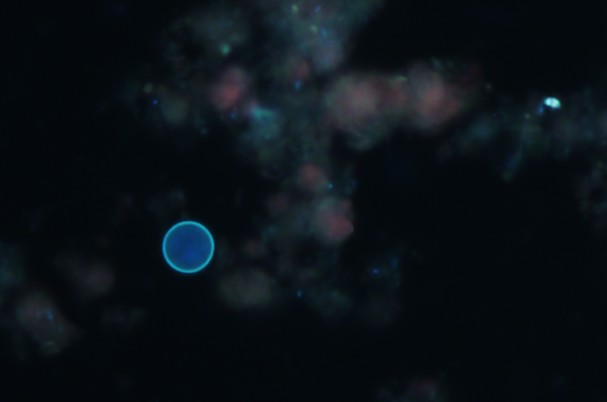 Cyclospora oocysts under ultraviolet fluorescence microscopy