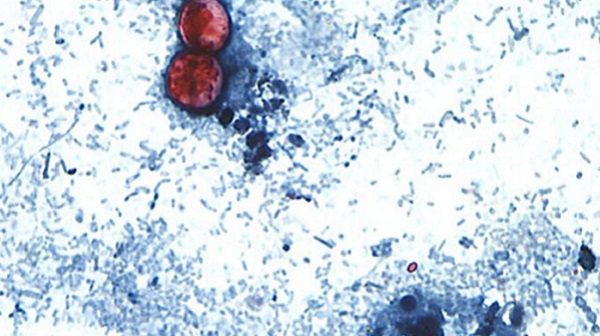 cyclospora image Cyclospora