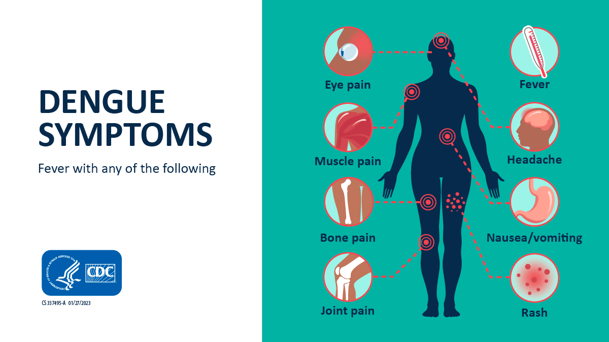 Human silhouette with callout graphics with dengue symptoms.