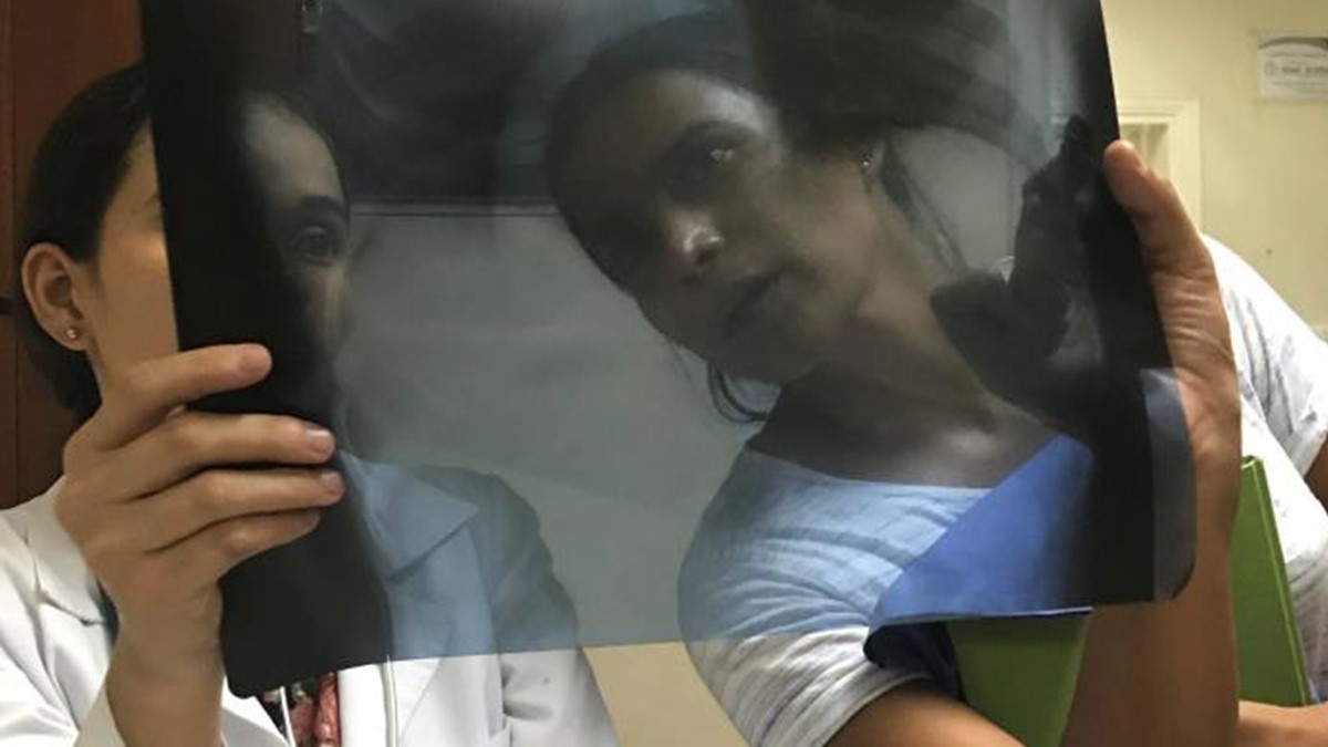 Doctors examining an X-ray of a dengue patient.