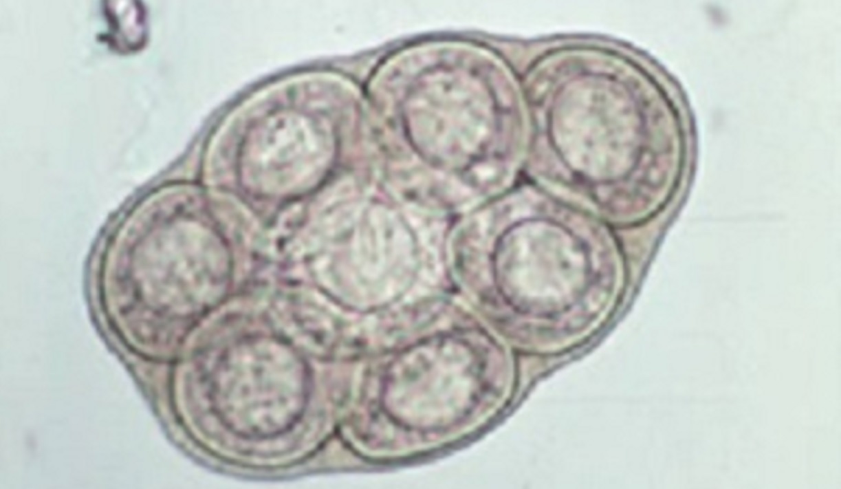 Microscopic view of dipylidium parasite
