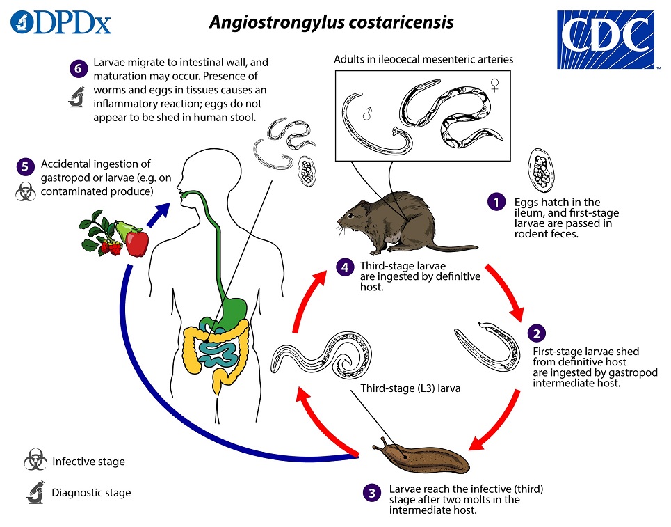 Angio cost_LifeCycle_19 lifecycle image