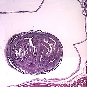Case154_A.jpg