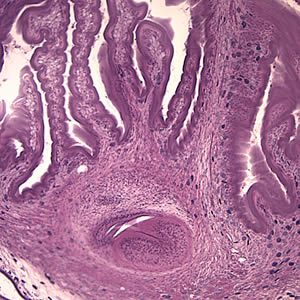 Case154_B.jpg