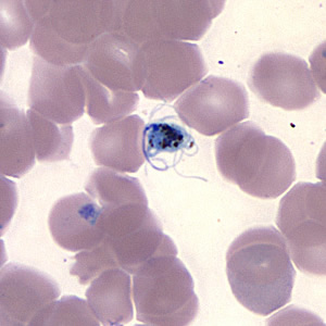 Case157_F.jpg