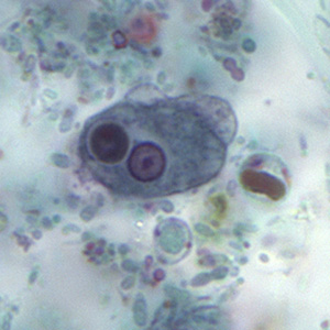 Case158_D.jpg