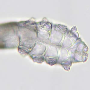 Case159_B.jpg