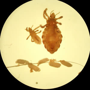 Case162_A.jpg
