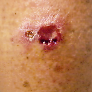 September - 2005 - Case #164