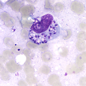 Case164_B.jpg