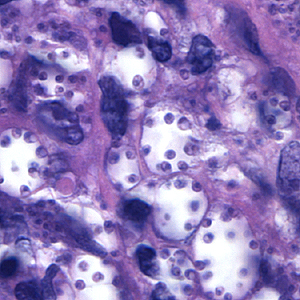 Case164_D.jpg