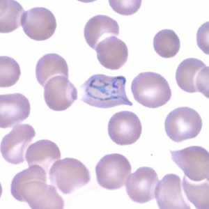 Case165_B.jpg