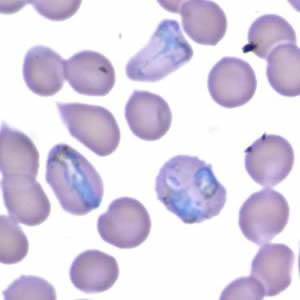 Case165_D.jpg