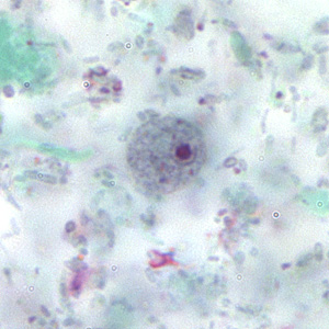 Case167_D.jpg