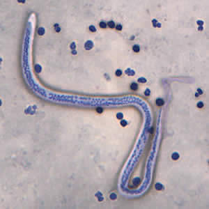 Case168_A.jpg