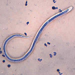 Case168_B.jpg