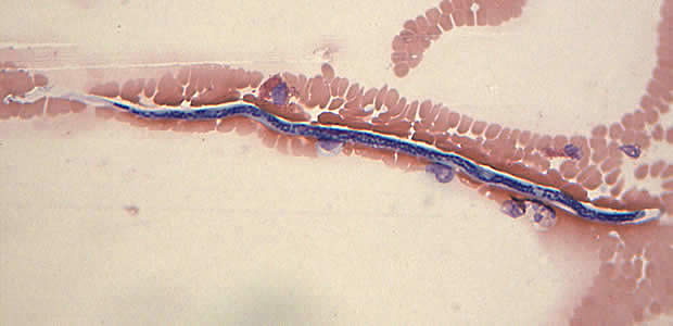 Case168_C.jpg