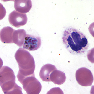 Case173_D.jpg
