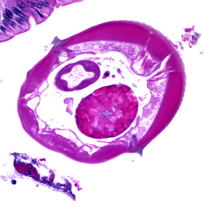 Case174_C.jpg