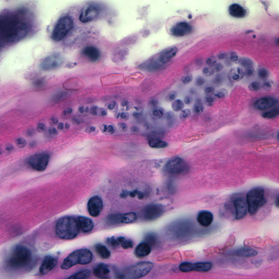 Case176_C.jpg