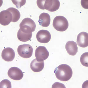 Case177_B.jpg
