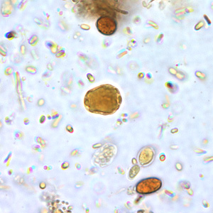 Case178_B.jpg