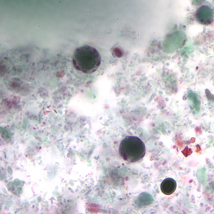 Case178_C.jpg