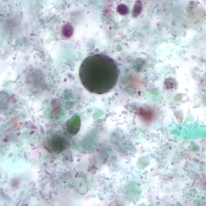 Case178_D.jpg