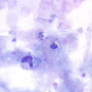 Case190_B.jpg