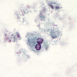 Case194_B.jpg
