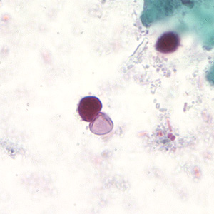 Case194_C.jpg